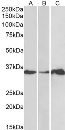 Anti-LASP1 antibody used in Western Blot (WB). GTX21301