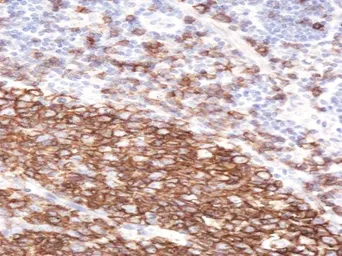 Anti-CD20 antibody, C-term used in IHC (Paraffin sections) (IHC-P). GTX21310