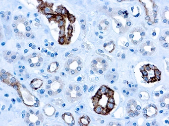 Anti-CD63 antibody [NKI/C3 (MX-49.129.5)] used in IHC (Paraffin sections) (IHC-P). GTX21318