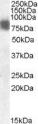 Anti-Cortactin antibody, N-term used in Western Blot (WB). GTX21374