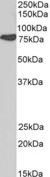 Anti-Cortactin antibody, N-term used in Western Blot (WB). GTX21374