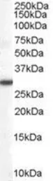 Anti-DDAH2 antibody used in Western Blot (WB). GTX21383