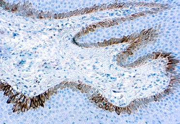 Anti-Cytokeratin 15 antibody [LKH15] used in IHC (Paraffin sections) (IHC-P). GTX21385