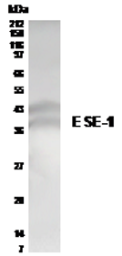 Anti-ESE1 antibody used in Western Blot (WB). GTX21392