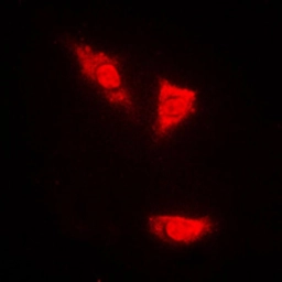 Anti-p53 (phospho Ser15) antibody used in Immunocytochemistry/ Immunofluorescence (ICC/IF). GTX21431