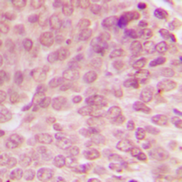 Anti-p53 (phospho Ser15) antibody used in IHC (Paraffin sections) (IHC-P). GTX21431
