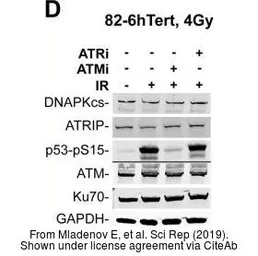 Anti-p53 (phospho Ser15) antibody used in Western Blot (WB). GTX21431