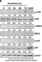 Anti-p53 (phospho Ser15) antibody used in Western Blot (WB). GTX21431
