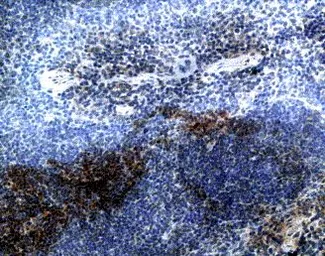 Anti-CCR7 antibody used in IHC (Paraffin sections) (IHC-P). GTX21657