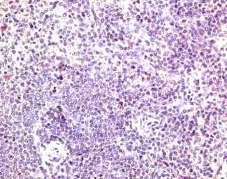 Anti-CCR7 antibody used in IHC (Paraffin sections) (IHC-P). GTX21657