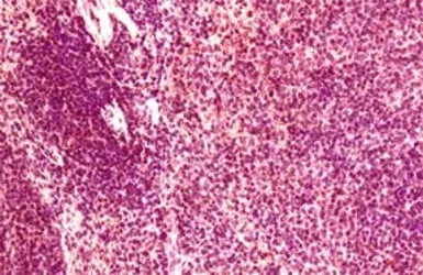 Anti-CCR6 antibody used in Immunohistochemistry (IHC). GTX21659