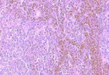 Anti-CCR8 antibody used in IHC (Paraffin sections) (IHC-P). GTX21666