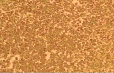 Anti-CCR3 antibody used in Immunocytochemistry/ Immunofluorescence (ICC/IF). GTX21667