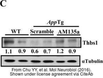 Anti-Thrombospondin antibody [A6-1] used in Western Blot (WB). GTX21823