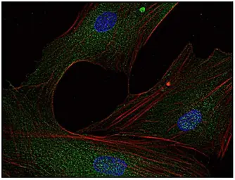 Anti-FYN antibody [FYN-01] used in Immunocytochemistry/ Immunofluorescence (ICC/IF). GTX21881