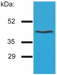 Anti-HLA-G antibody [MEM-G/4] used in Western Blot (WB). GTX21887