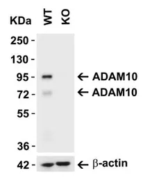 Anti-ADAM10 antibody used in Western Blot (WB). GTX21997