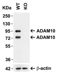 Anti-ADAM10 antibody used in Western Blot (WB). GTX21997