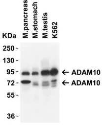Anti-ADAM10 antibody used in Western Blot (WB). GTX21997