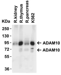 Anti-ADAM10 antibody used in Western Blot (WB). GTX21997