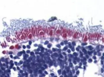 Anti-AIF antibody used in IHC (Paraffin sections) (IHC-P). GTX21998