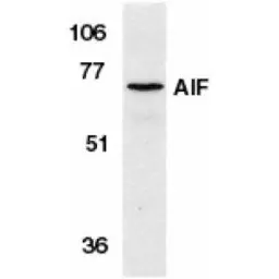 Anti-AIF antibody used in Western Blot (WB). GTX21999