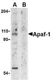 Anti-APAF1 antibody used in Western Blot (WB). GTX22001