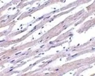Anti-APAF1 antibody used in Immunohistochemistry (IHC). GTX22001