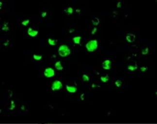 Anti-APAF1 antibody used in Western Blot (WB). GTX22001