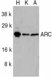 Anti-NOL3 antibody used in Western Blot (WB). GTX22002
