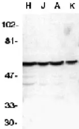 Anti-Caspase 10 antibody used in Western Blot (WB). GTX22012