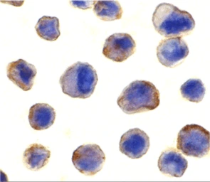 Anti-MADD antibody used in Immunocytochemistry/ Immunofluorescence (ICC/IF). GTX22043