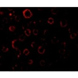 Anti-MADD antibody used in Immunocytochemistry/ Immunofluorescence (ICC/IF). GTX22043