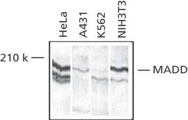 Anti-MADD antibody used in Western Blot (WB). GTX22043
