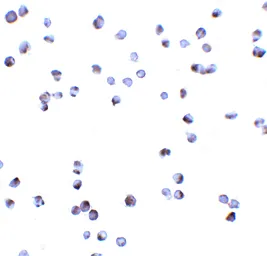 Anti-DAP Kinase 3 antibody used in Immunocytochemistry/ Immunofluorescence (ICC/IF). GTX22057