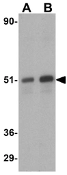 Anti-DAP Kinase 3 antibody used in Western Blot (WB). GTX22057