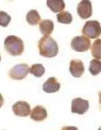 Anti-DAP Kinase 3 antibody used in Immunocytochemistry/ Immunofluorescence (ICC/IF). GTX22057