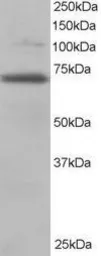 Anti-RanGAP1 antibody, N-term used in Western Blot (WB). GTX22081