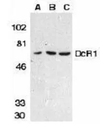 Anti-DcR1 antibody used in Western Blot (WB). GTX22087