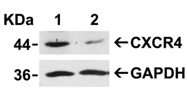 Anti-CXCR4 antibody used in Western Blot (WB). GTX22090