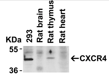 Anti-CXCR4 antibody used in Western Blot (WB). GTX22090