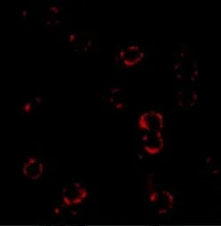 Anti-CXCR4 antibody used in Immunocytochemistry/ Immunofluorescence (ICC/IF). GTX22090
