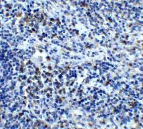 Anti-CXCR4 antibody used in IHC (Paraffin sections) (IHC-P). GTX22090