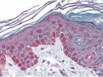 Anti-Cyclin T1 antibody used in IHC (Paraffin sections) (IHC-P). GTX22098