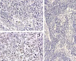 Anti-IL1 beta antibody used in IHC (Paraffin sections) (IHC-P). GTX22105