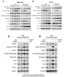 Anti-IL1 beta antibody used in Western Blot (WB). GTX22105