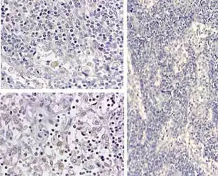 Anti-IL1 beta antibody used in IHC (Paraffin sections) (IHC-P). GTX22105