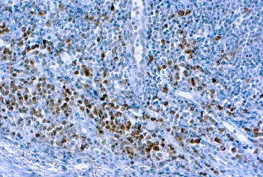 Anti-Caspase 3 antibody [3CSP03] used in IHC (Paraffin sections) (IHC-P). GTX22171
