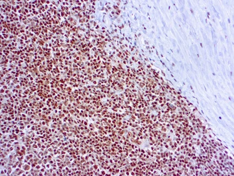 Anti-RPA32 antibody [9H8] used in IHC (Paraffin sections) (IHC-P). GTX22175