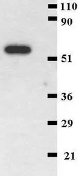 Anti-CD41 antibody [MEM-06] used in Western Blot (WB). GTX22211